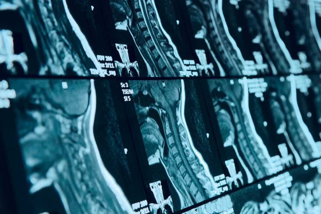 changes after chiropractic adjustment