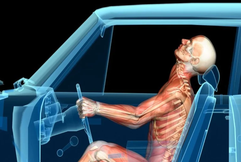 Chiropractic Treatment for Whiplash