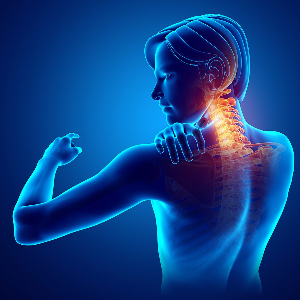 Can Chiropractic Care Help Arthritis in the Neck