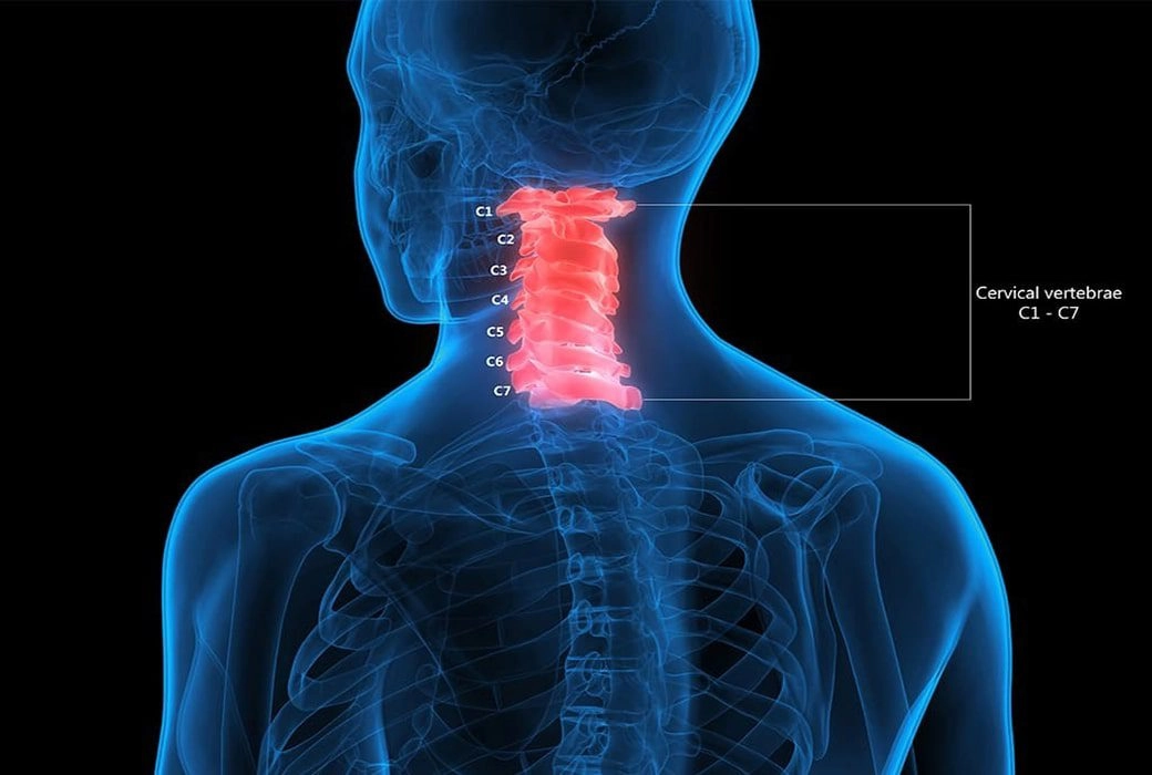 C1 and C2 Vertebrae Misalignment Symptoms