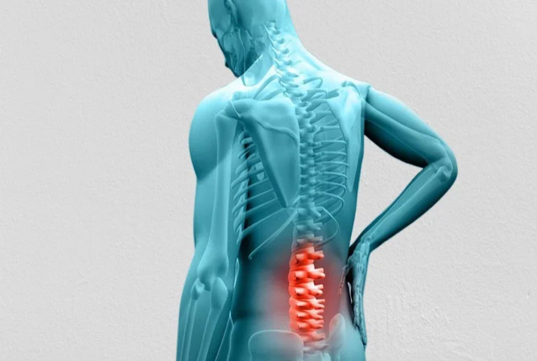 A n x-ray anatomy of a male body, with red highlight on the lower back vertebrae of the spine.