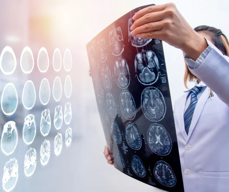 A doctor looking at a brain MRI scans