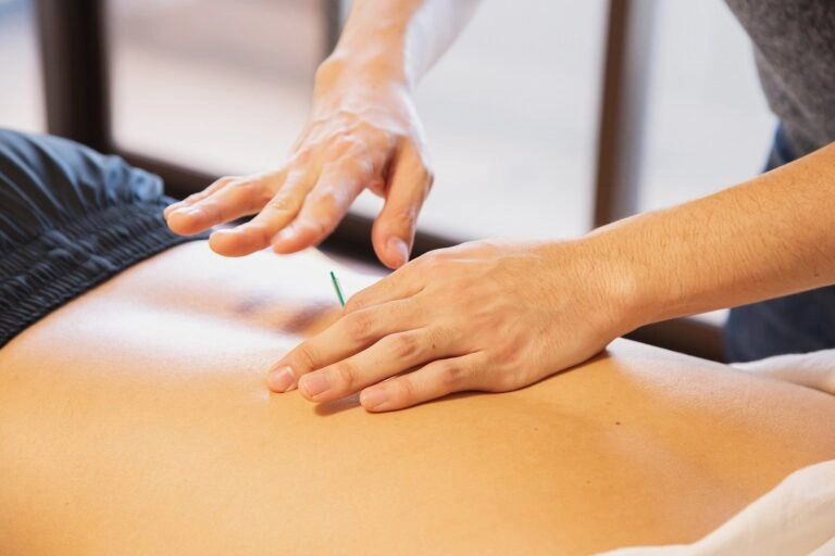 A back getting acupuncture.