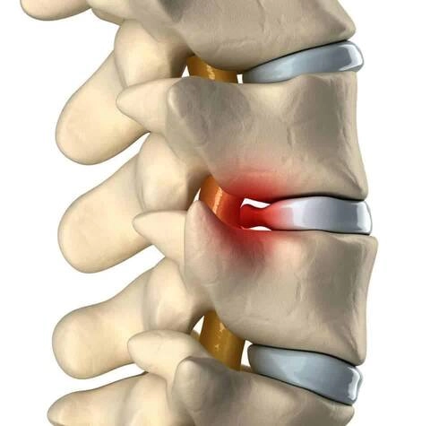 An anatomical representation of a middle section of a spine.